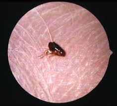 Le but est de prévenir les infestations et assurer un traitement préventif pour éviter à votre chien des souffrances comme les démangeaisons, problèmes. Dossier Les Puces Chez Le Chien Et Le Chat Clinique Veterinaire Des Etessiaux Dr Seznec Dr Lobry Dr Roret Dr Lacourt 95000 Cergy