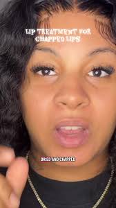liptreatment #lipcareproducts #lipcare #tiktokshopblackfriday #tiktok...