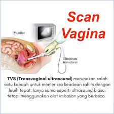 Appointment (sepatutnya) klinik dr hamid arshat 14/12/2017 (cd14) 8:00 am tapi oleh kerana period lambat datang 6 hari, so tangguhlah jawapnya hehe. Dr Hamid Arshat Home Facebook
