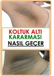 Koltuk Alti Kararmasi Neden Olur Ve Nasil Gecer Koltuk Alti Cilt Tedavileri Cilt Ipuclari