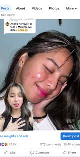 Erica Pineda Teeth Before and After