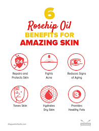 Rosehip oil benefits for hair: 7 Rosehip Oil Benefits For Amazing Skin Natural Healthy