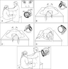 Image result for Canalith Repositioning Procedure
