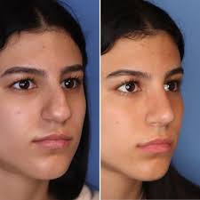 Dr. Thomas Romo III (@drthomasromo) • Instagram photos and videos