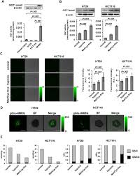 Rapid Detection Of Metastatic Lymph Nodes Of Colorectal Cancer With A Gamma Glutamyl Transpeptidase Activatable Fluorescence Probe Scientific Reports