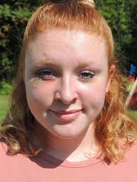 SGFHS: Girl, 14, attacked, suffers concussion & 3 stitches to eye; video  recorded