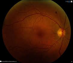 Image result for Chorisochora transvaalensis