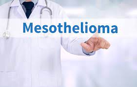 It usually depends on the involvement of workers&#x27; Mesothelioma Compensation Mesotheliomahelp Org