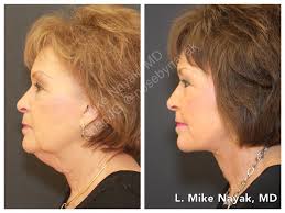 Dr. Nayak is one of the few...