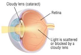 Image result for Diplopia