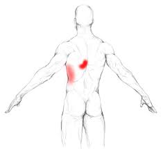 Serratus Anterior Schmerzen Triggerpunkte Selbst Behandeln