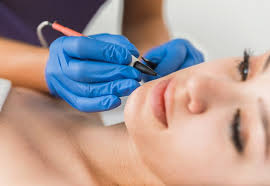 Use of electricity in hair removal. Electrolysis Refresher Bronwyn Conroy Beauty School
