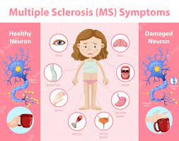 Multiple sclerosis is an autoimmune disease that attacks the nerves. Free Vector Multiple Sclerosis Ms Symptoms Information Infographic