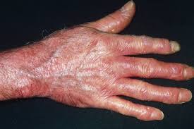 Image result for Scleroderma geaster