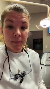 Teeth Whitening for Brown Stained Teeth Results