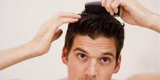 Kafa Derisindeki Sivilceler Neden Cikar Hangi Dogal Yontemler Kurtulmaya Yardimci Olur