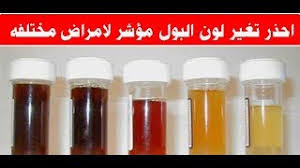 يُمكن أن تشمل أسباب البول المُعكر ما يلي: Ù„ÙˆÙ† Ø§Ù„Ø¨ÙˆÙ„ ÙŠÙƒØ´Ù Ø§Ù„Ø­Ø§Ù„Ø© Ø§Ù„ØµØ­ÙŠØ© Ù…Ø§ÙƒØªÙŠÙˆØ¨Ø³ ÙƒÙŠÙ ØªØ¹Ø±Ù Ù…Ø§ Ù‡ÙŠ Ø£Ù…Ø±Ø§Ø¶ Ø¬Ø³Ø¯Ùƒ Ø­Ø³Ø¨ Ù„ÙˆÙ† Ø§Ù„Ø¨ÙˆÙ„