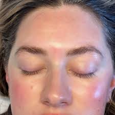 Chloe Wester (@chlo_glow_skin) • Instagram photos and videos