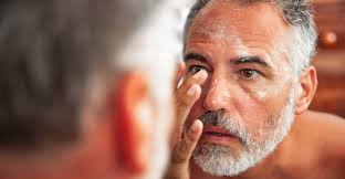 SOS brûlures d'été !