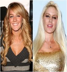 She has not confirmed the anti aging procedures but accredited surgeons argue that the lack of wrinkles and sagging cheeks at the … Top 18 Celebs With Plastic Surgery