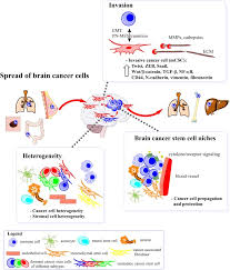 The rise seems to be driven, in large part, by an increase in leukemia, which is up almost 35% since 1975. Brain Malignancies Glioblastoma And Brain Metastases Sciencedirect