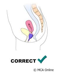Menstrual cups are a reusable alternative to tampons using menstrual cups can be challenging at first, so you may need to try different techniques to make it work for you. How To Use A Menstrual Cup Menstrual Cups Australia Online