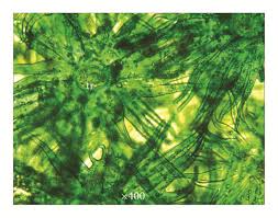 Image result for Phragmanthera