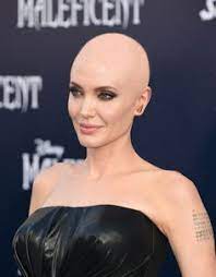 Shaving off the hair and going completely bald take immense courage and super high confidence for a woman. 55 Hair Restoration Ideas Hair Restoration Hair Loss Remedies Hair Loss