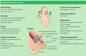 Inguinal Hernia Pediatrics Elective Surgery Nicu Nurse