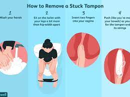 In reality, tampons come with a very real risk of toxic shock syndrome (tss). How To Remove A Stuck Tampon