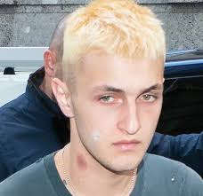 Did Anwar Hadid Have a Huge Hickey at Milan Fashion Week?