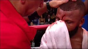 Check out badou jack vs marcus browne fight preview, watch the bout live on january 19, 2019, on showtime at 9 p.m. Boxer Badou Jack Received One Of The Nastiest Cuts On His Forehead During Match Video Total Pro Sports
