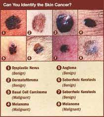 Pin On Health