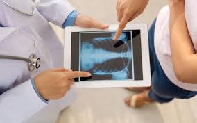 Intercostal Neuralgia Overview And More