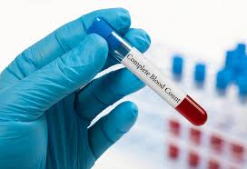 When your blood is tested, ask for your wbc count and specifically, your neutrophil count. Cbc Test During Pregnancy Importance Tests Results