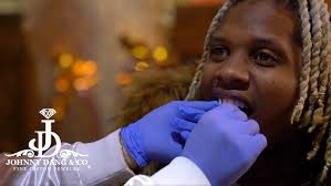 Lil Durk Gets Diamond Fangs!