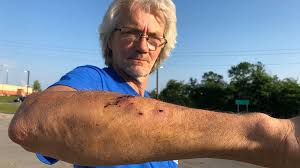 And it's all caught in this wild video. Every Time It Bit Me I Could Hear Crunch Crunch Crunch Pennsylvania Man Attacked By Rabid Bobcat Retells Experience Cbs Pittsburgh