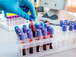 Aprenda a matéria e mande bem nas provas! 4 Coletas De Material Para Exames Laboratoriais Laboratorio Verner Willrich