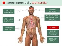 Ipotensione ipertensione trombosi sindrome da perdita capillare. Tachicardia Ventricolare Atriale Sinusale O Parossistica Sintomi Cause E Rimedi