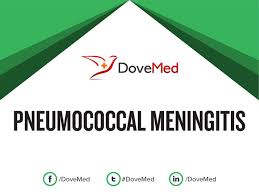 And sometimes, pneumococcal disease can lead to serious infections like pneumonia, meningitis, bacteremia, and. Pneumococcal Meningitis