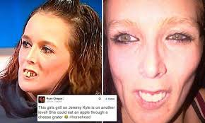 Jeremy Kyle pays £10,000 to fix guest Gemma Swift's tombstone teeth