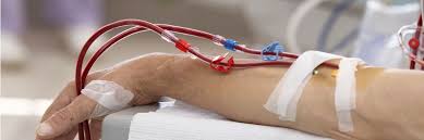 A person without kidneys that is not on dialysis may only live from a few days to several weeks before dying. Nihr Evidence The Weekly Break From Dialysis Is Harmful To Patients With Kidney Failure Informative And Accessible Health And Care Research