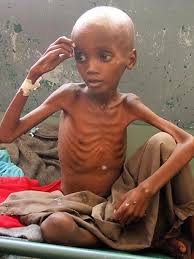 Résultat de recherche d'images pour "children starving"