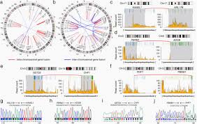 Check spelling or type a new query. Bap1 Loss Predicts Therapeutic Vulnerability In Malignant Peritoneal Mesothelioma Biorxiv