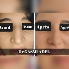 Dr.GASMI ADEL chirurgie maxillo-faciale د.قاسمي عادل