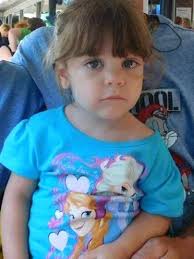 Mom of burned, dead girl was burned as a child