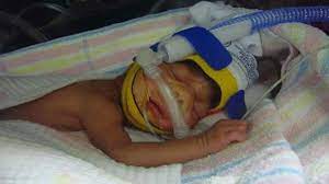 When maternity patients attend appointments or are admitted to hospital, we will be checking the temperature of birth partners and anyone with a temperature of 37.8 °c or above will be requested to leave the hospital. Swslhd Liverpool Hospital Newborn Care Nicu Home Page