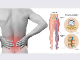 8 Sciatica Stretches To Help Prevent And Relieve Hip And Lower Back Pain
