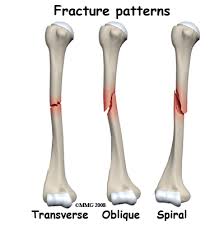 Image result for Humerus Bone