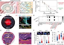 Recommendations from an international expert panel. Leukemia On A Chip Dissecting The Chemoresistance Mechanisms In B Cell Acute Lymphoblastic Leukemia Bone Marrow Niche Science Advances